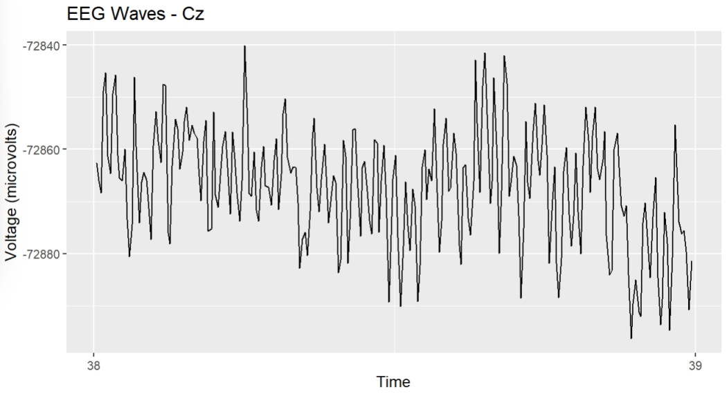 Unfiltered Cz Channel during 1 second epoch