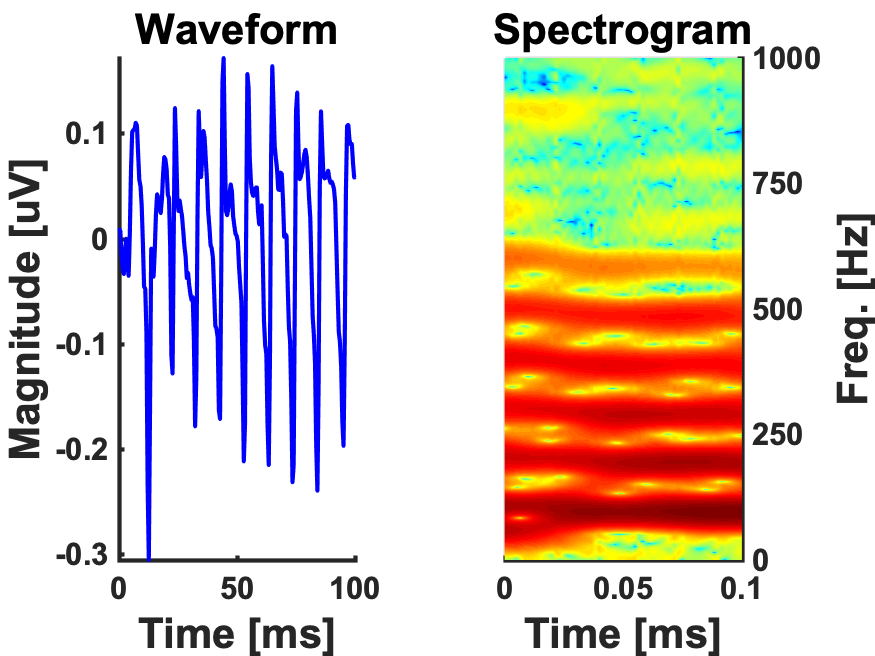 100ms &lsquo;da&rsquo; syllable-FFR (<em>N=26</em>)