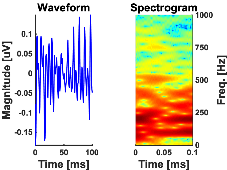 100ms piano tone-FFR (<em>N=26)</em>