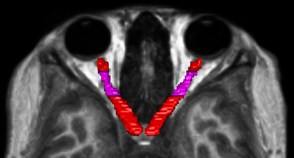 Segmentation Alignment