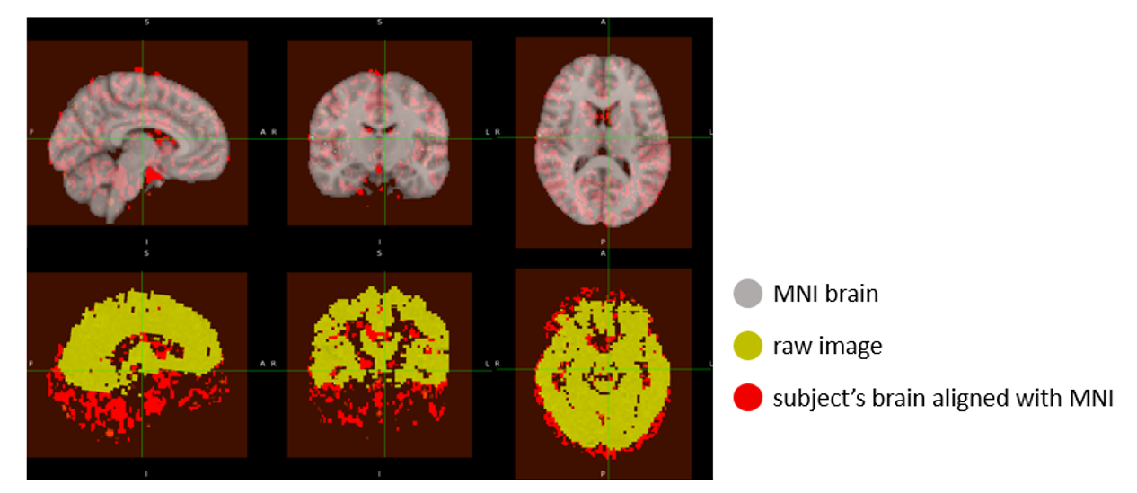 Hippocampus Beta Map