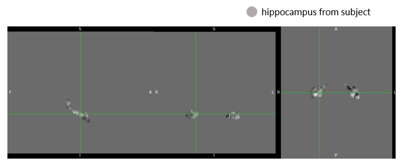 Hippocampus Beta Map