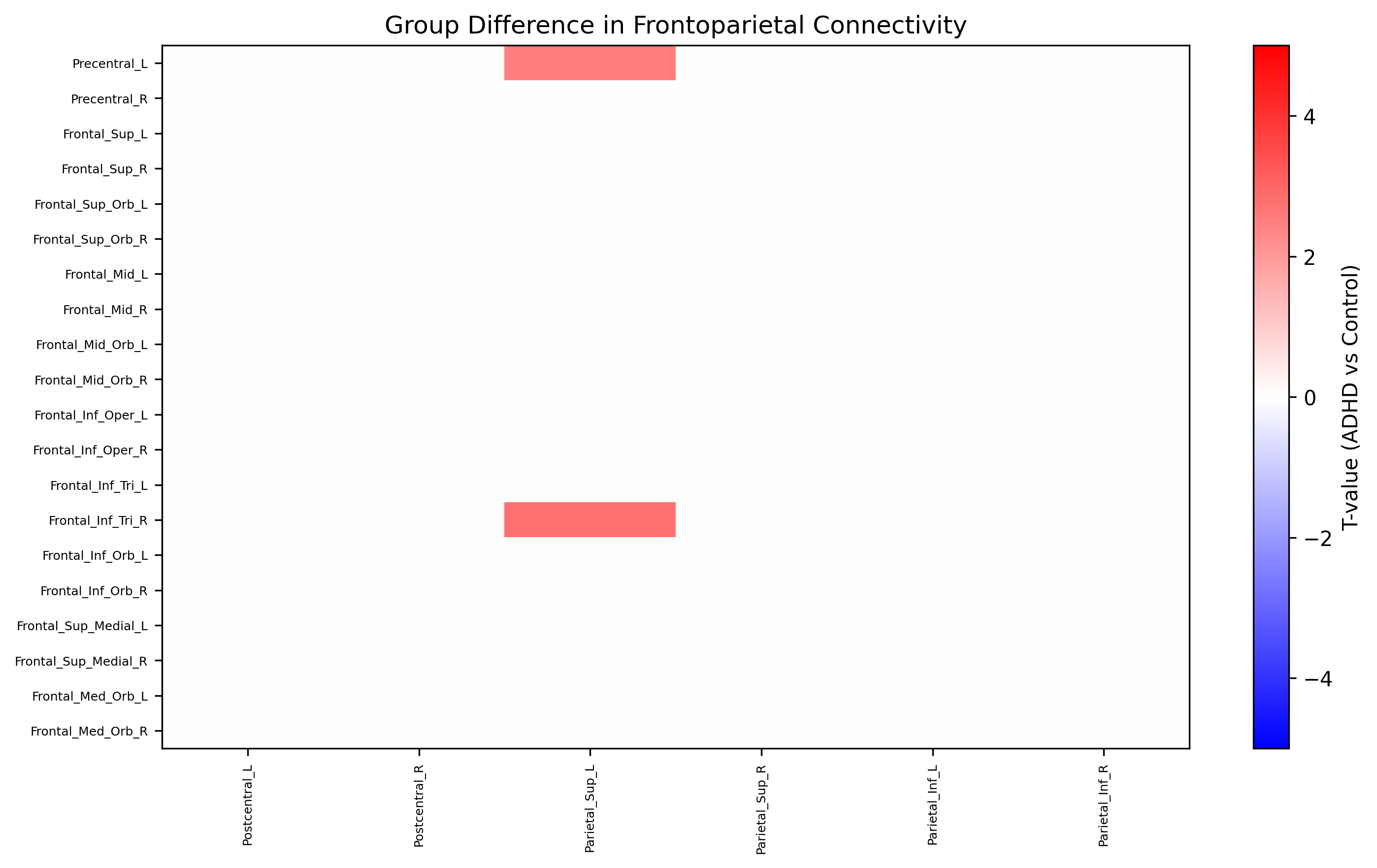 signdifferencesinfrontoparietalconnec